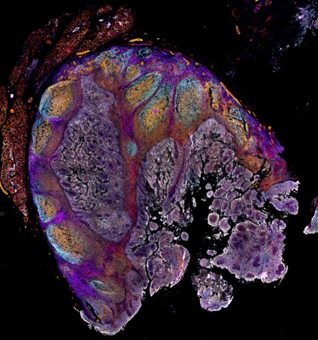 Stained tonsil tissue captured using the EVOS S1000 Spatial Imaging System. (Photo: Business Wire)